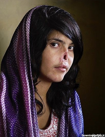 دختر۱۸ ساله قربانی طالبان + عکس