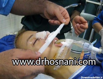 ترشحات بینی بعد از جراحی بینی - دکتر حمیدرضا حسنانی