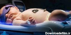 درمان زردی نوزاد با شیر خشک | از شایعه تا واقعیت