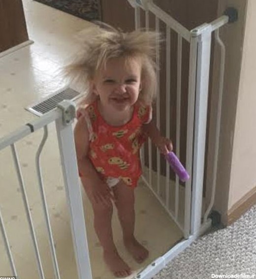 دختربچه 2 ساله، صاحب عجیب‌ترین موهای دنیا! (عکس)