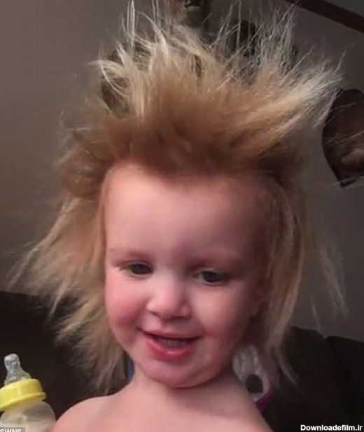 دختربچه 2 ساله، صاحب عجیب‌ترین موهای دنیا! (عکس)