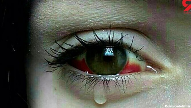 عکس گران ترین گریه دنیا دلتان را می لرزاند ! / اوج فقر و انسانیت ...
