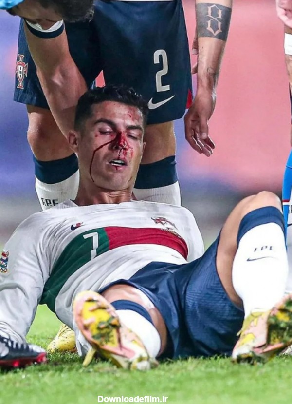 تصویر دلخراش از ستاره دنیای فوتبال/ رونالدو غرق در خون + عکس