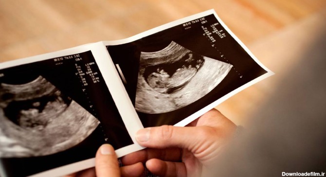 تفاوت جنین دختر و پسر در سونوگرافی هفته 12 در چیست؟ + عکس ...