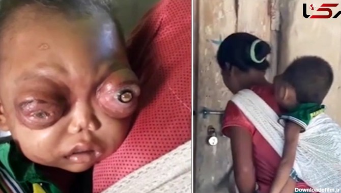 چشم های وحشتناک کودک 2 ساله همه را شوکه کرد + فیلم و عکس