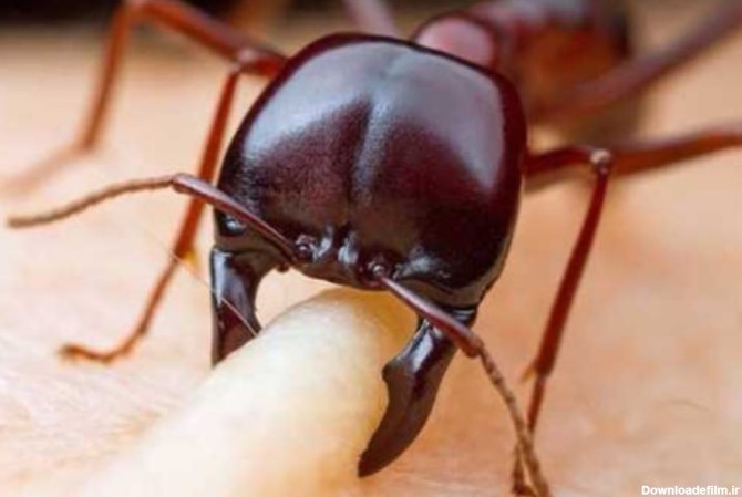 آخرین خبر | گاز گرفتن مورچه از نزدیک