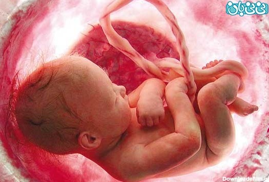 سقط جنین، دلایل و خطرات آن