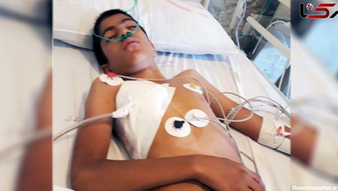 این پسر 13 ساله از دست عزرائیل گریخت / او سلاخی شده بود! + فیلم و عکس