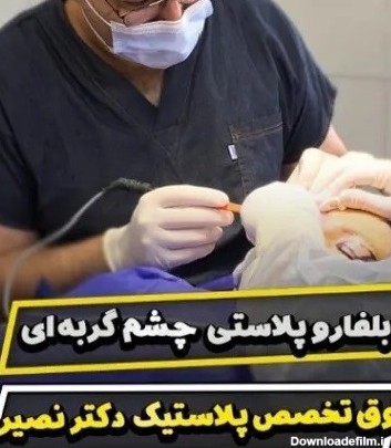 دکتر عمل چشم‌گربه‌ای در تهران