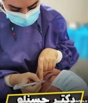 دکتر عمل چشم‌گربه‌ای در تهران