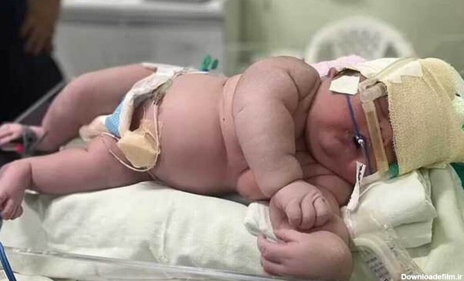 تولد نوزاد ۷ کیلویی در مشهد