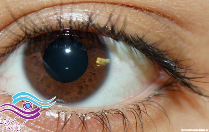 چرا قهوه‌ای رایج‌ترین رنگ چشم است