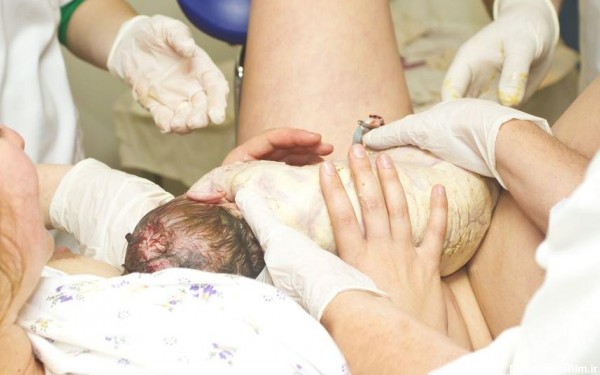 عکس زن حامله در حال زایمان طبیعی در اب