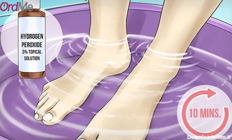 تمیز کردن لکه های پا برای زیباتر شدن ناخن های پا