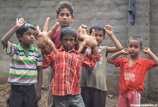 بیماری عجیب پسر بچه هندی +عکس