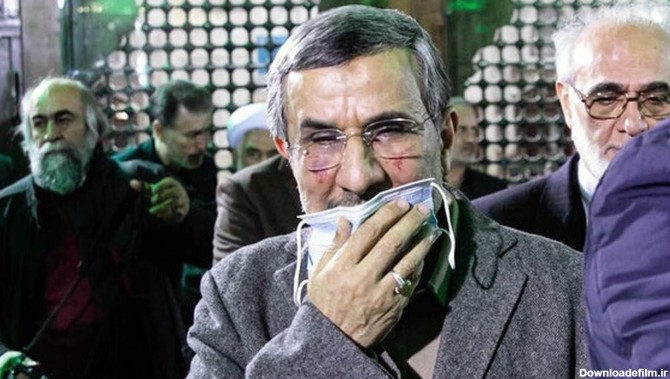محمود احمدی نژاد عمل زیبایی کرد ! + عکس های کبودی صورتش بعد جراحی ...