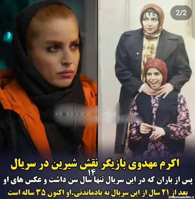 تغییر چهره بازیگر زن ایرانی پس از باران ! + عکس