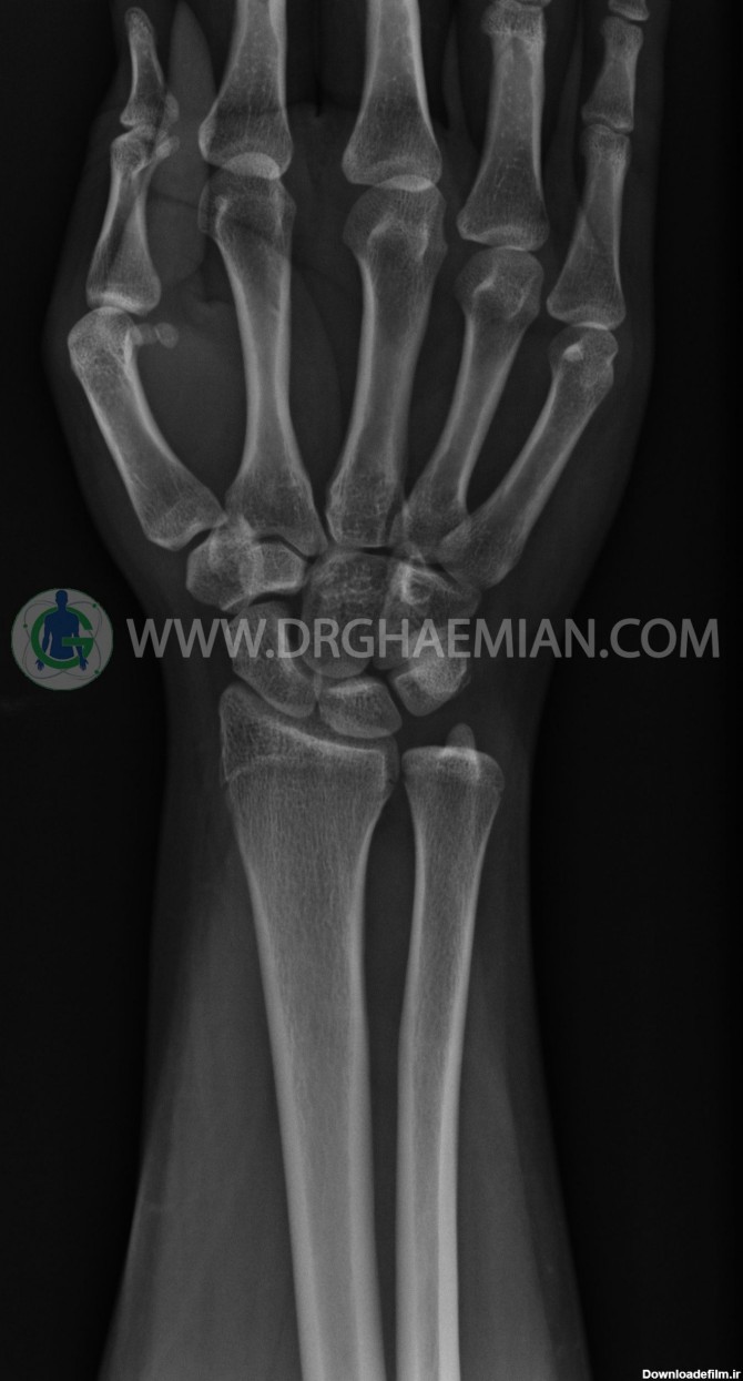 رادیولوژی مچ دست - دکتر قائمیان | مرکز تصویر برداری پزشکی ...