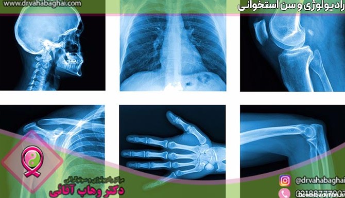 تشخیص سن استخوانی با رادیولوژی | مجموعه تصویربرداری دکتر وهاب آقایی