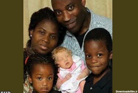 نوزادی متفاوت در خانواده سیاه پوست +عکس