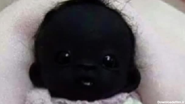 سیاه ترین نوزاد جهان - بهترین ها - تماشا