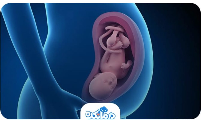 متن جایگزین: تصویری که پایین آمدن سر جنین در بارداری را نشان می‌دهد.