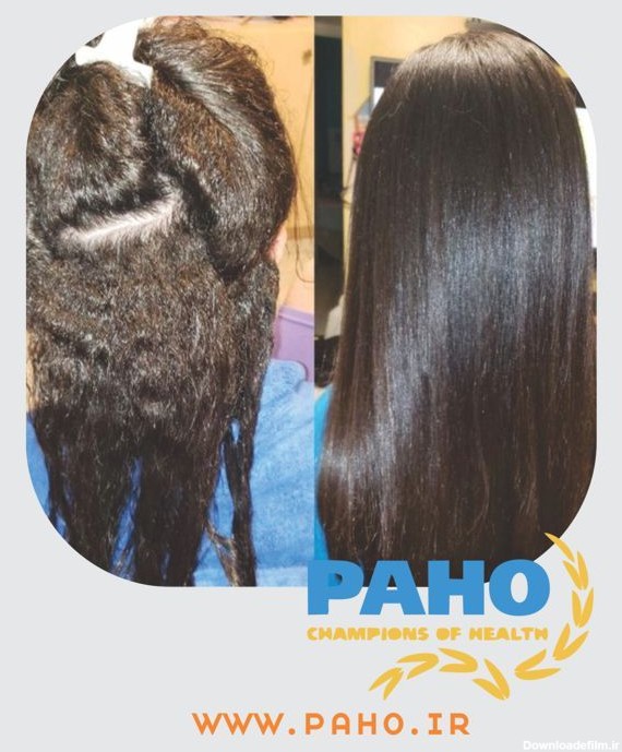 بوتاکس مو مشهد | درمان عمیق موهای آسیب دیده | paho