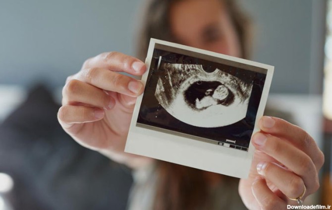 هفته دهم بارداری چگونه است؟ وضعیت مادر و جنین و مراقبت های هفته ۱۰