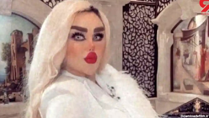 خانم باربی عراقی با ۴۳ عمل زیبایی زامبی شد ! + عکس حیرت انگیز