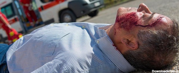 ضربه مغزی بعد از تصادف – سایت شخصی دکتر نوراله اشراقی