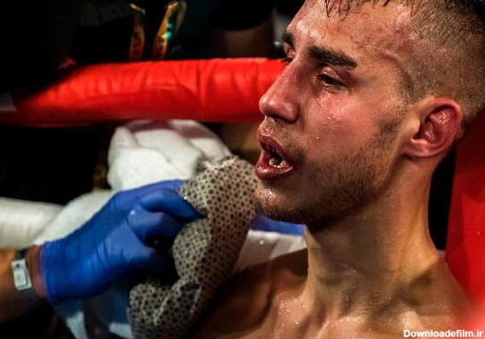 بوکسور معروف بعد از ۱۱ راند مبارزه ضربه مغزی شد + عکس