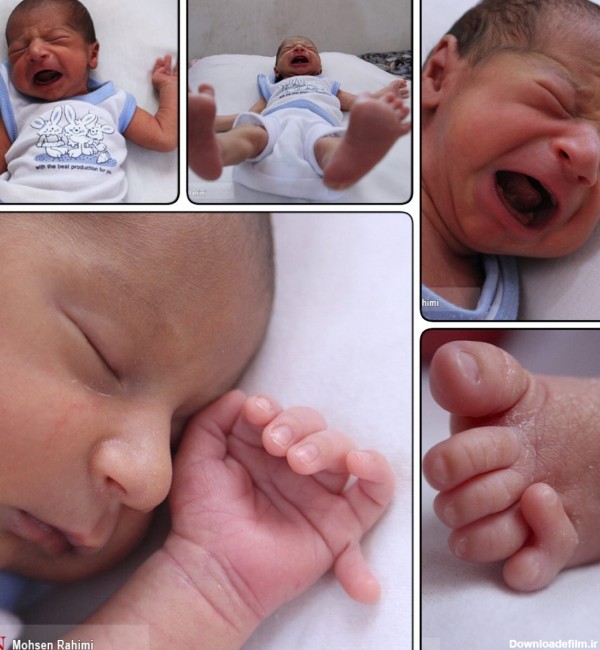 نوزادی با ۲۴ انگشت در شهرستان گناباد متولد شد/ عکس - خبرآنلاین