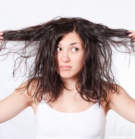 علت چرب شدن موی سر مردان و زنان چیست و آیا درمان قطعی وجود دارد؟