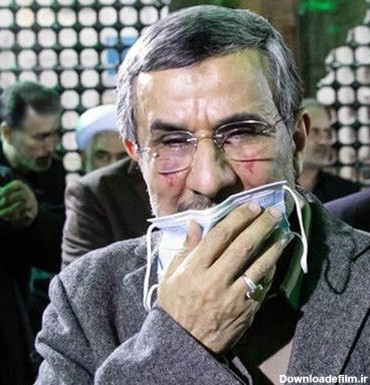 محمود احمدی نژاد عمل زیبایی کرد ! + عکس های کبودی صورتش بعد جراحی پلاستیک ! + عکس ها