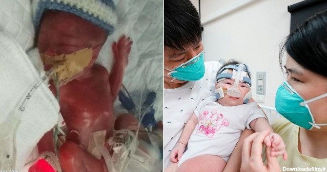 فرارو | (تصاویر) کوچک‌ترین نوزاد دنیا از بیمارستان مرخص شد