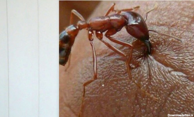 عکس | تصویری ترسناک از یک مورچه از نمایی بسیار نزدیک | - ساناپرس