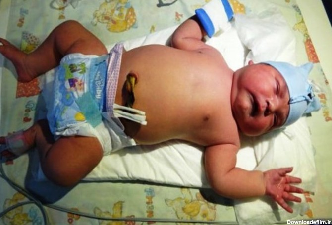 تولد نوزاد ۶ کیلویی در میاندوآب/ عکس | پایگاه خبری جماران