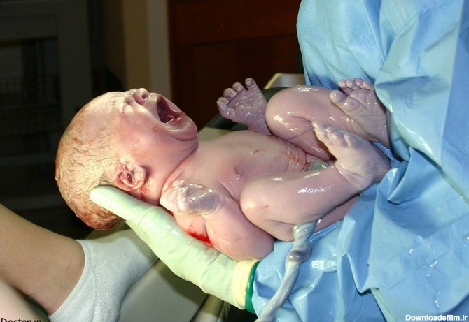 تاریخ تولد لاکچری و بروز سندرم تنفسی در نوزادان | پایگاه اطلاع ...