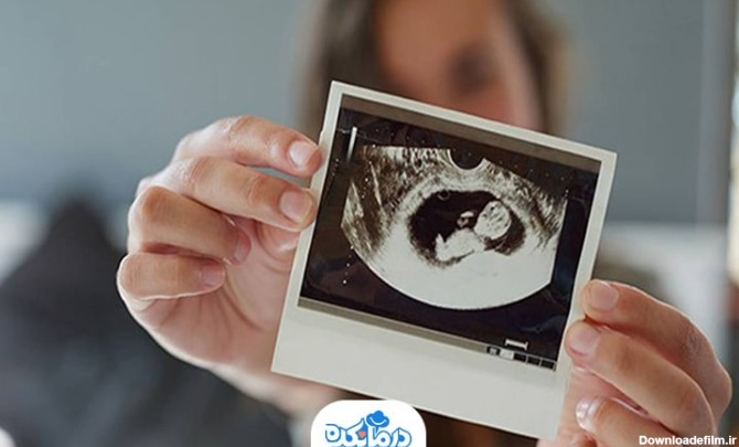 تفاوت جنین دختر و پسر در سونوگرافی چیست؟ + بهترین زمان تشخیص