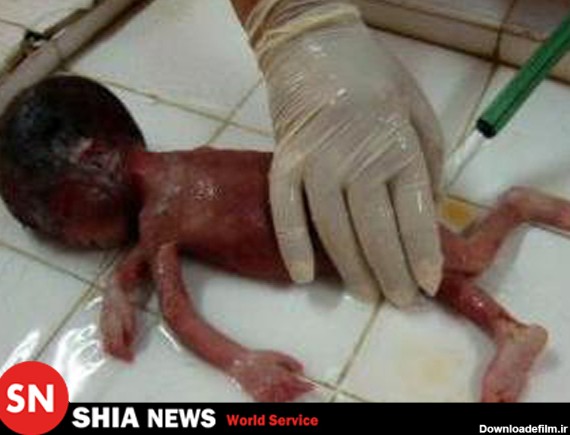 شهادت فجیع یک زن بحرینی و جنین هشت ماهه اش + عکس (18+)