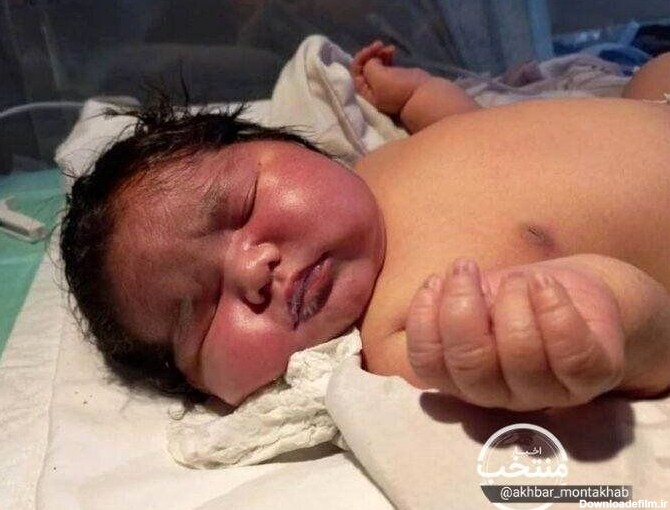 این نوزاد مشهدی سنگین وزن ترین نوزاد متولد شده جهان است؟/ عکس