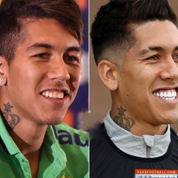 رونالدو ؛ تصویر رونالدو ، بکام و فیرمینو قبل و بعد از عمل زیبایی دندان