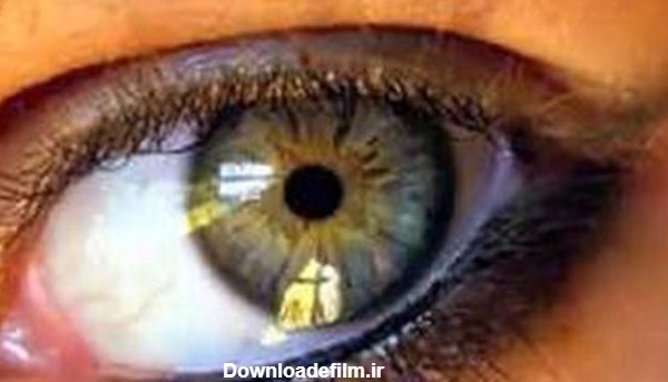سابلیمینال و بیوکنزی تغییر رنگ چشم به تیله ای( چندرنگ)