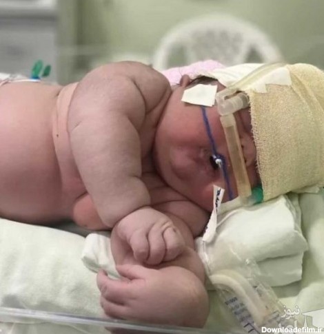 تولد نوزاد ۷ کیلویی با ۶۰ سانتیمتر قد از طریق سزارین +عکس