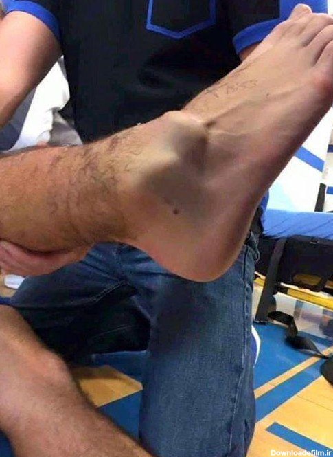 فیلم لحظه وحشتناک شکستن پای آندره گومز بازیکن اورتون+عکس | شهرآرانیوز