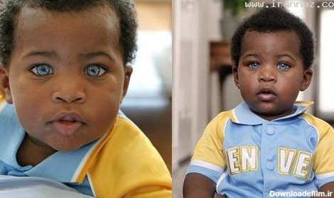 این پسر آفریقایی زیباترین چشم جهان را دارد! (عکس)