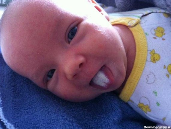 برفک دهان نوزاد |علائم و علل نی نی لیست