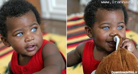 این پسر آفریقایی زیباترین چشم جهان را دارد! (عکس)