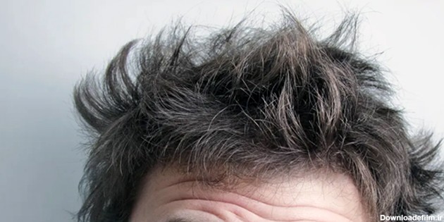 خشکی مو در آقایان ، علت به وجود آمدن و راههای مقابله با آن | گالری یاس