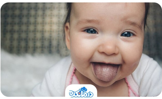 نوزادی که لکه‌هایی سفید در دهان او وجود دارد.